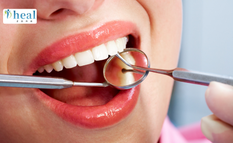 Dental Tourism: Why More Patients Are Flying India for Dental Care