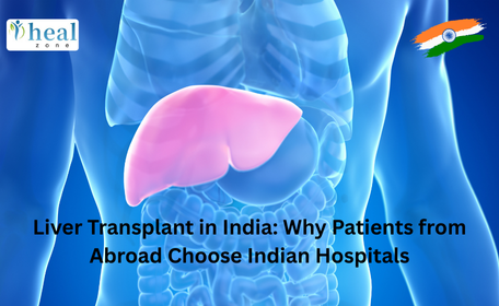 Liver Transplant in India: Why Patients from Abroad Choose Indian Hospitals