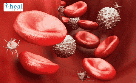 Pediatric Blood Cancers: Causes, Symptoms, Diagnosis, and Treatment