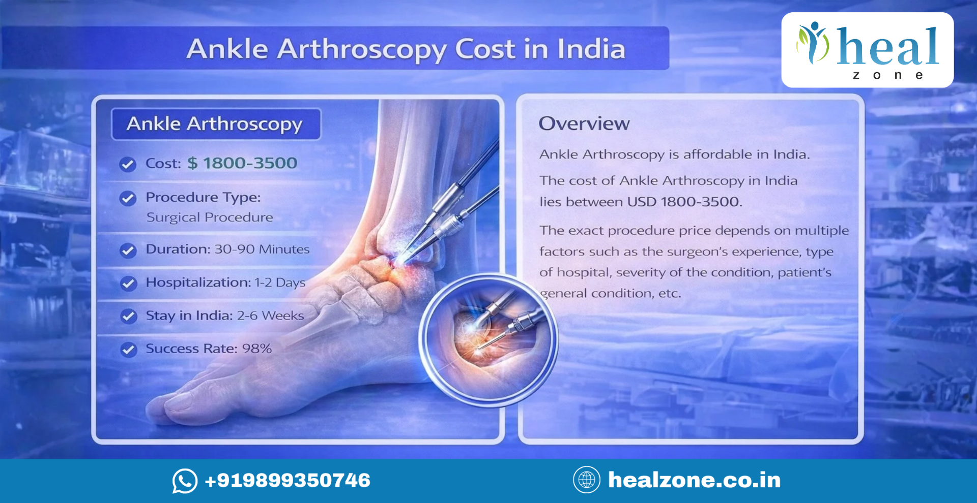 Ankle Arthroscopy