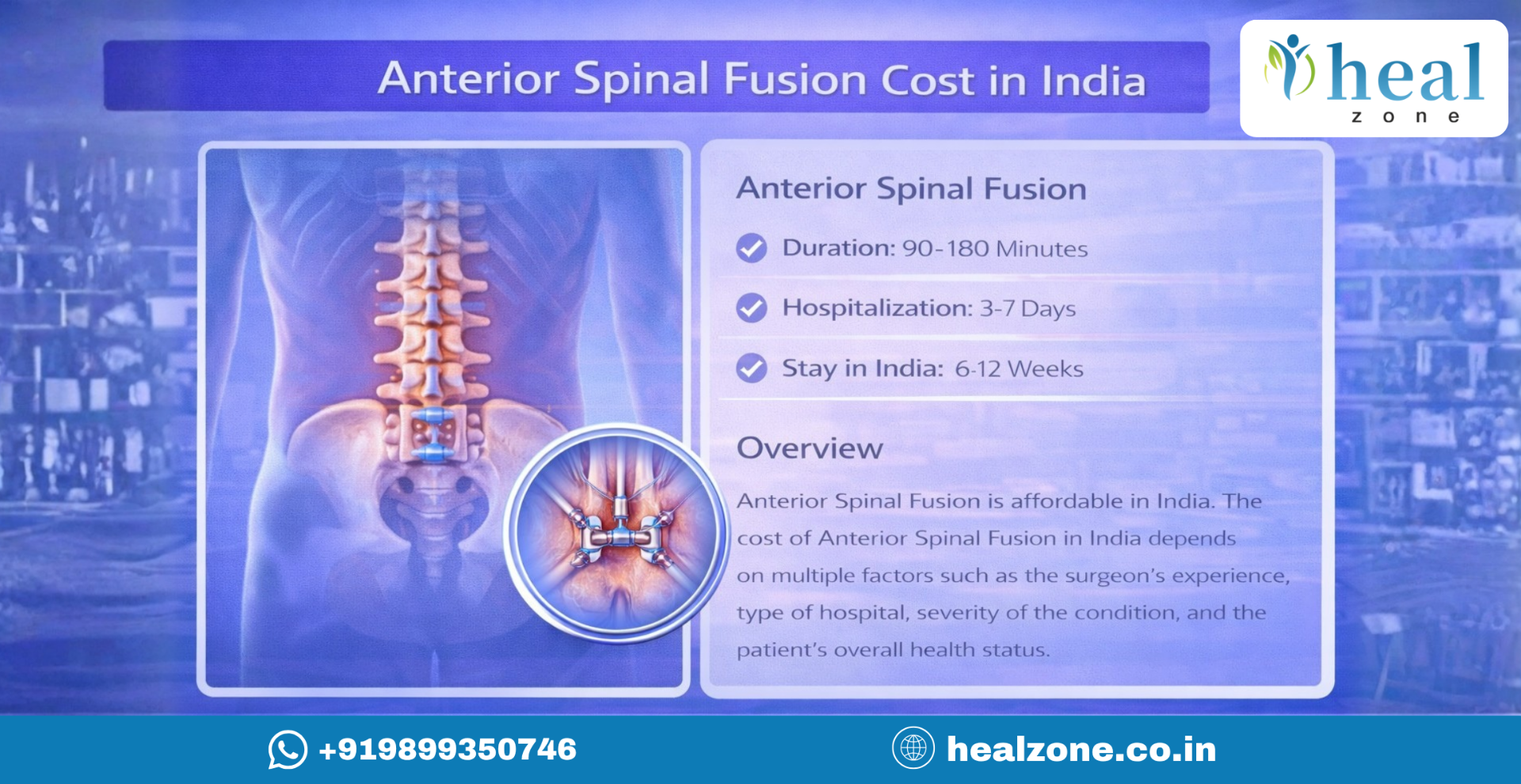 Anterior Spinal Fusion
