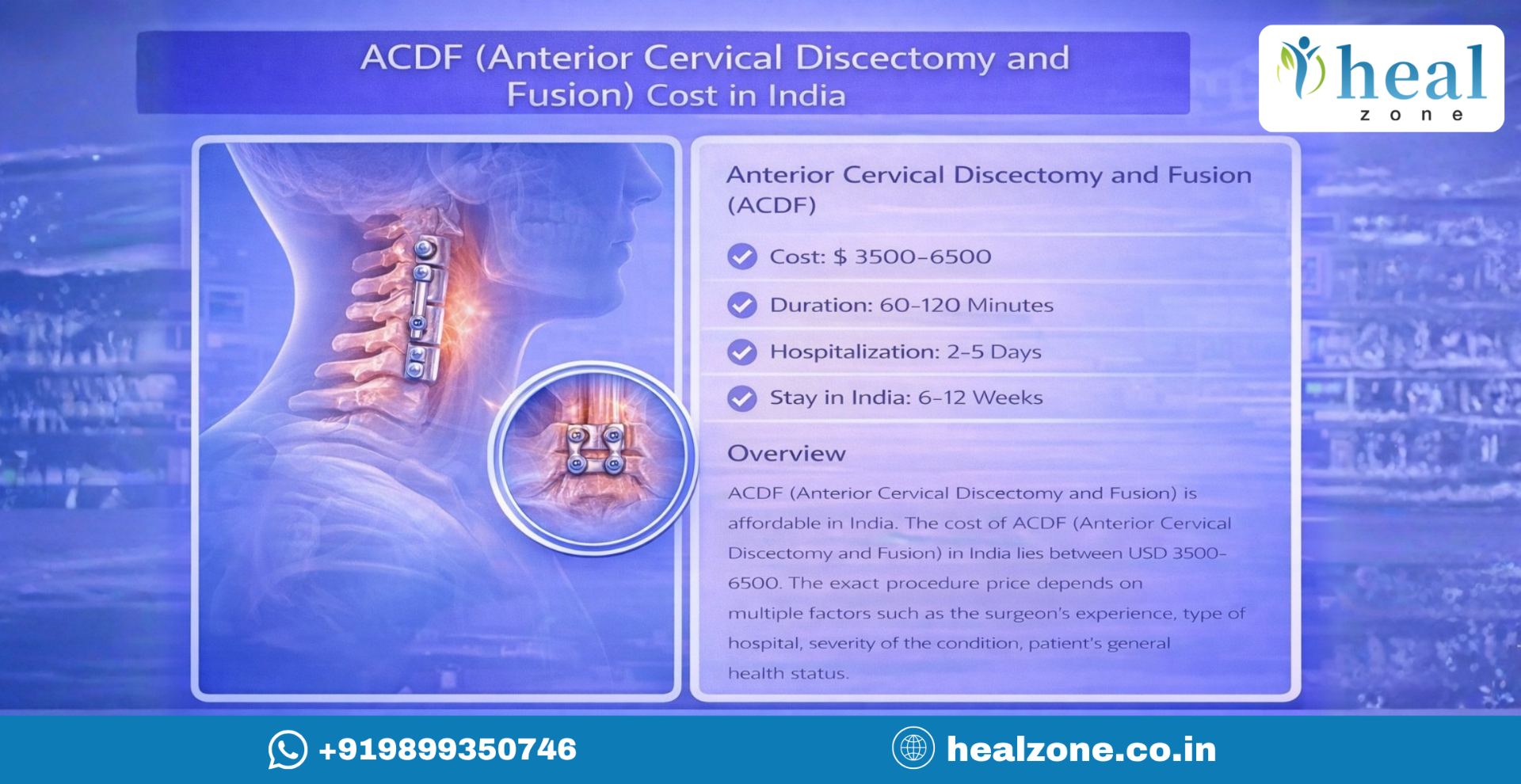Anterior Cervical Discectomy and Fusion - ACDF