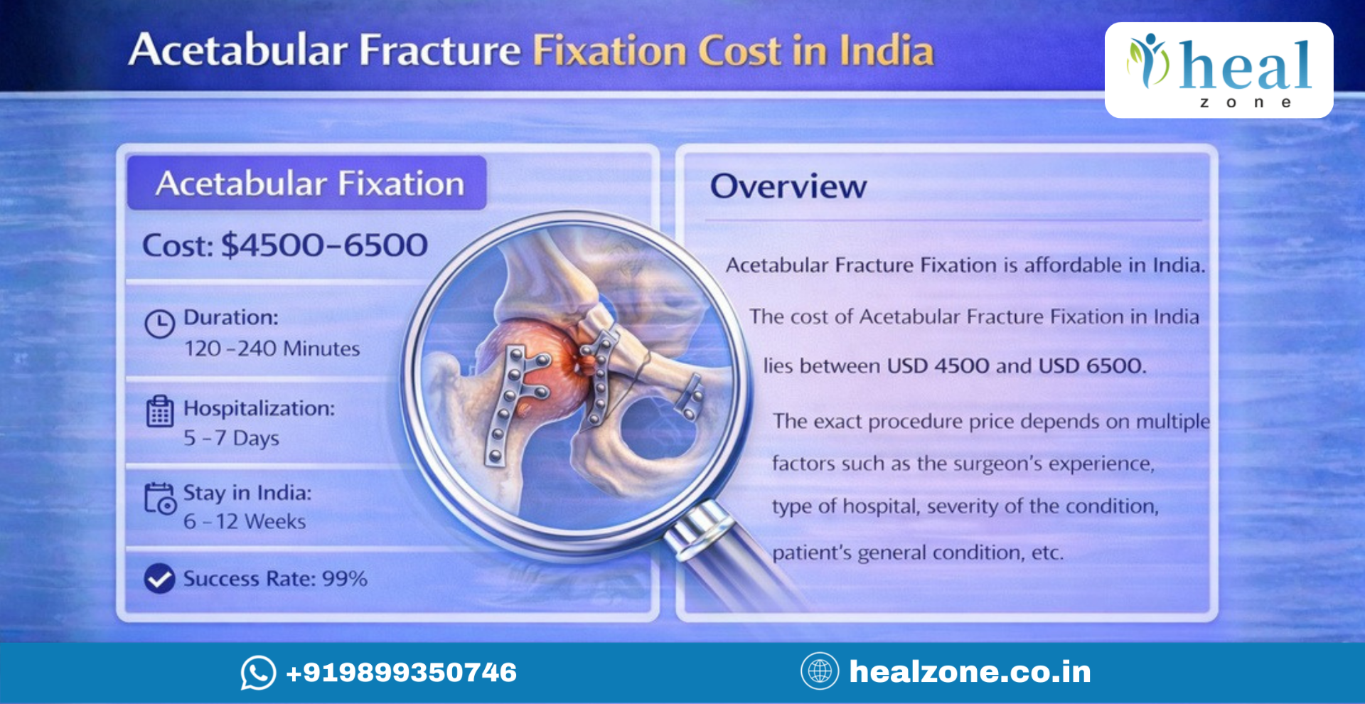 Acetabular Fixation