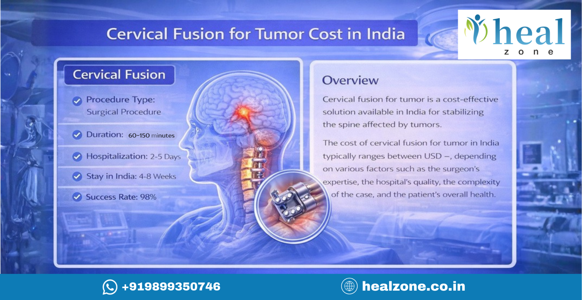 Cervical Fusion