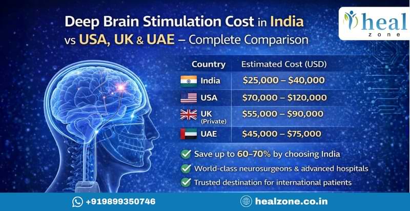 Deep Brain Stimulation Cost in India vs USA, UK & UAE &ndash; Complete Comparison