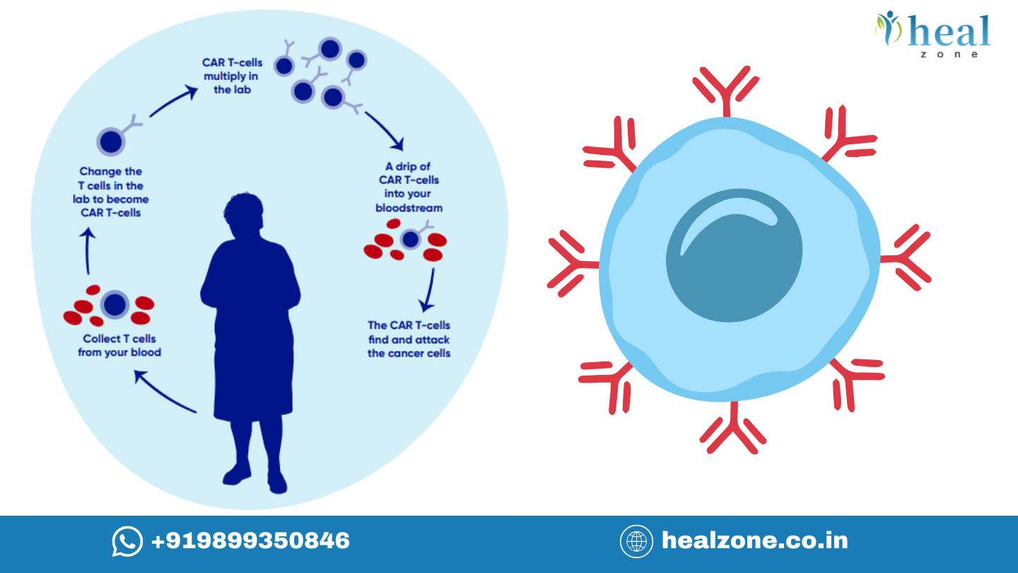 How CAR-T Cell Therapy is Changing Blood Cancer Treatment