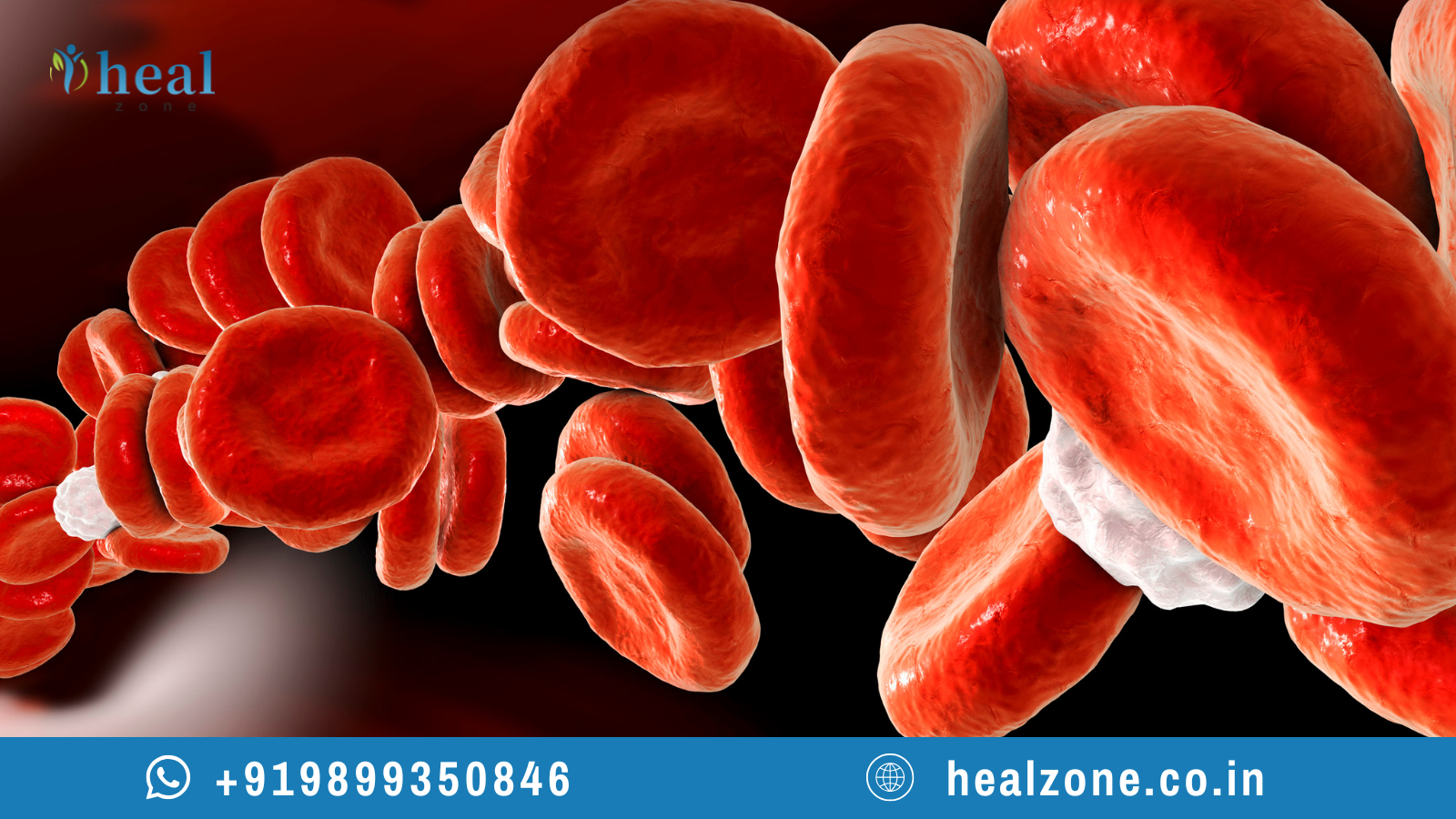 Best Hematologists in India (2026): A Complete Guide for International Patients