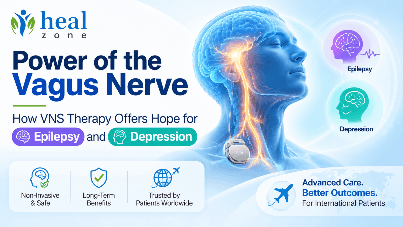 Power of the Vagus Nerve: How VNS Therapy Offers Hope for Epilepsy and Depression