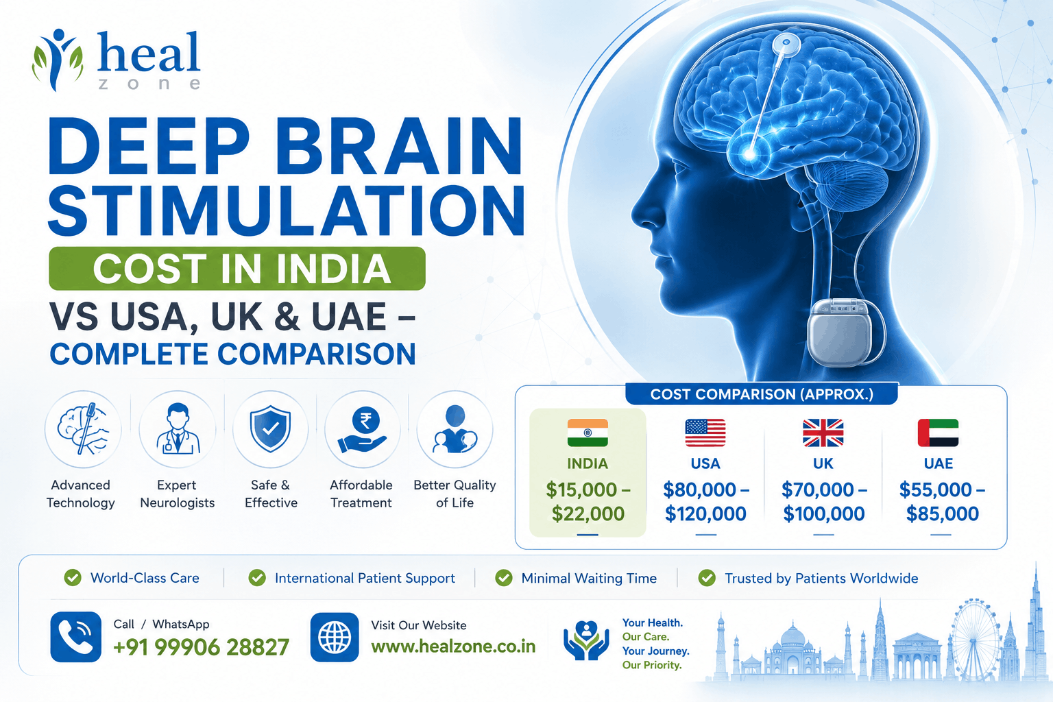 Deep Brain Stimulation Cost in India vs USA, UK & UAE &ndash; Complete Comparison