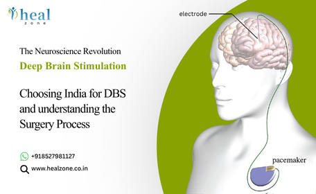 Deep Brain Stimulation (DBS) Cost in India
